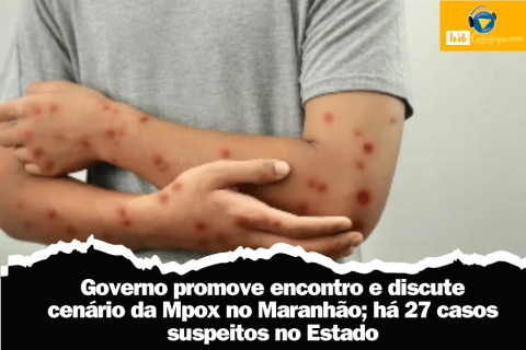 Governo promove encontro e discute cenário da Mpox no Maranhão; há 27 casos suspeitos no Estado