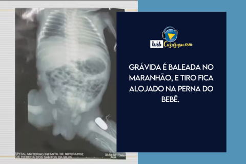 Grávida é baleada no Maranhão, e tiro fica alojado na perna do bebê.