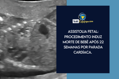 Assistolia fetal: Procedimento induz morte de bebê após 22 semanas por parada cardíaca.